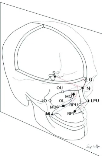 Fig. 2. Three-dimensional (3D) co-ordinates of the sella and nasion in a PACS as the reference line for angular measurement