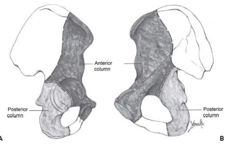 Figure 1-1 - Extrapelvic (A) and intrapelvic (B) schematic views of the anterior and posterior columns of the pelvis