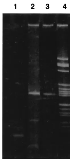 FIG. 2. RT-PCR ampliﬁcation of ZEBRA mRNA (182 bp) in PBMCs ob-tained from a bone marrow transplant recipient with EBV-associated B-cell