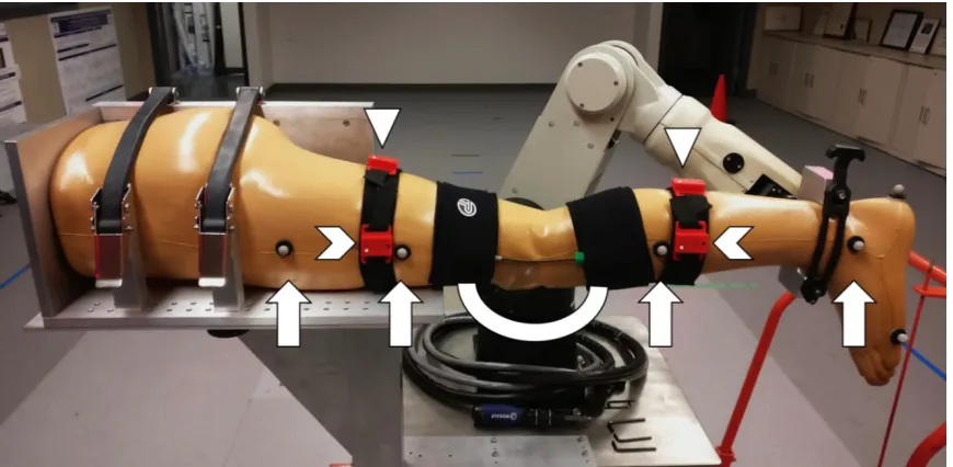 Figure 3: Experimental setup of the motion capture modalities on the leg phantom.  The upward pointing arrows indicate the 3D camera reflective markers used for 