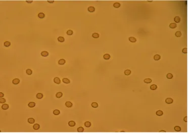 Figure 8: Microscopic hematuria: Red blood cells in a urine sample seen under the microscope