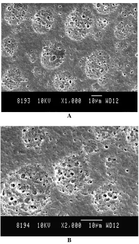 Figure 8.   SEM image of the sample PAN (75 wt.%) PMMA (25 wt.%) LiClO4 (8 wt.%) at a) X1000 and b)  X2000 