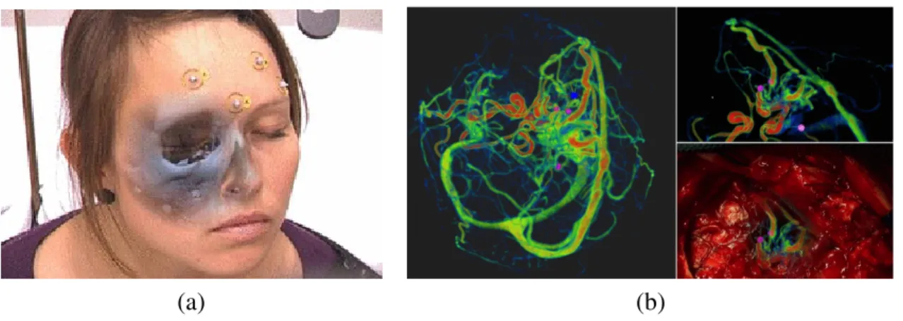 Figure 1.1: (a) A CT image registered to the patient is rendered in a video see-through HMD