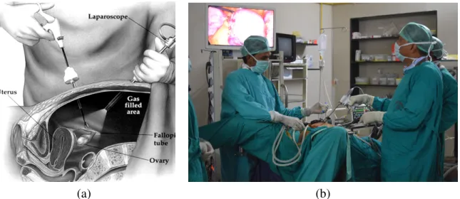Figure 1.2: (a) a cross section of the abdomen during a laparoscopic intervention. The sur-