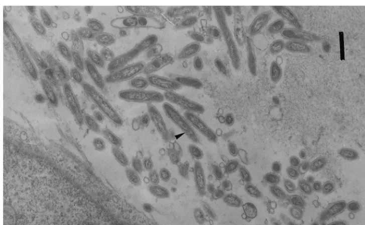 FIG. 1. Transmission electron micrograph showing the bacterium (arrowhead). Bar, 500 nm.