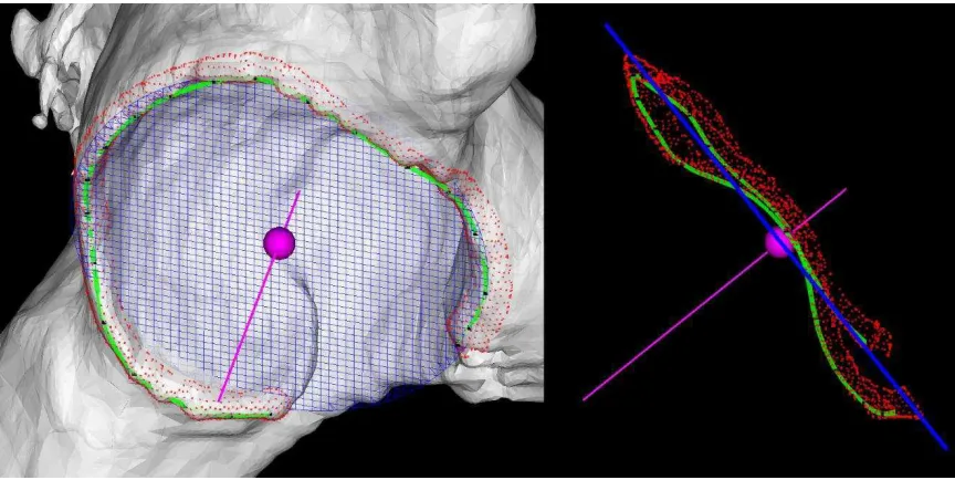 Fig. 5. Acetabular opening circle and axis determination. With about 20 nodes (black dots) manually located on the osseous ridge, a B-spline path (green) is built as the rim path using cubic interpolation