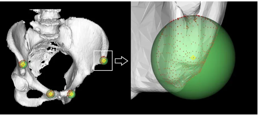 Fig. 1. Clipping landmark point sets on the pelvic surface. Four initial markers (yellow) are manually defined at positions near the landmarks