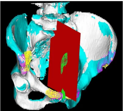 Fig. 4. MSP computation process. The initial mirrored shape (yellow) is transformed to maximally fit the original shape (white) after ICP registration