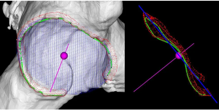 Fig. 5. Acetabular opening circle and axis determination. With about 20 nodes (black dots) manually located on the osseous ridge, a B-spline path (green) is built as the rim path using cubic interpolation