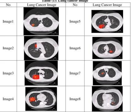 Table (1): Lung cancer image  Lung Cancer Image 