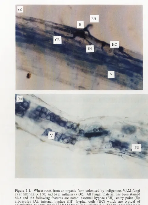 Figure 1.1. Wheat roots from an organic farm colonised by indigenous YAM fungi a) at tillering (x 150) and b) at anthesis (x 60)