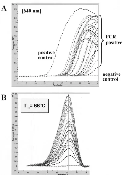 FIG. 2. Evaluation of the LightCycler PCR assay with brain tissue sections of C. neoformanswith various-infected mice