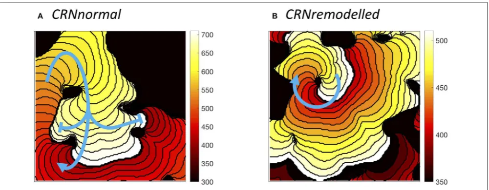 FIGURE 9 | Examples of sustained re-entry elicited by spiral wave initiation with the same pattern of heterogenous diffusion at a length scale of 10 mm.simulated tissue withpathway with period of around 310 ms in simulated tissue with (A) re-entry CRNnorma