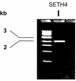 Figure 3.  Amplified PCR of coding region of SETH4 fragment with 2013 bp, (1 kb ladder used as Marker)