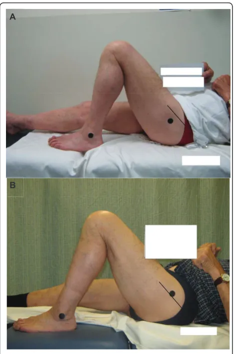 Figure 2 Different degrees of adiposity influence the ease withwhich bony landmarks can be identified.