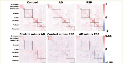 Figure 1 Connectivity matrices. Top: Association matrices derived from resting state (task-free) functional MRI