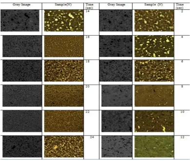 Fig. (1)(a) Shows Image of  Blood samples, and Gray Image of Healthy (N) Sample at a Threshold of (100)