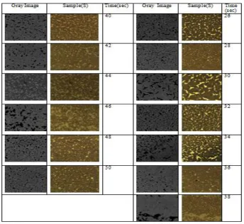 Fig(2)(a). shows Image of  Blood samples, and Gray Image of Smoker (S) sample  at a Threshold of (100)