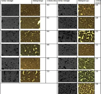 Fig(3)(a). shows Image of  Blood samples, and Gray Image of a Diabetes (D) sample at a Threshold of (100 (