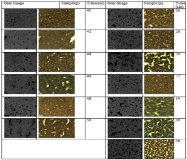 Fig(4)(a). Shows Image of  Blood samples, and Gray Image of  High Blood Pressure ( P) Sample at a threshold of (100)