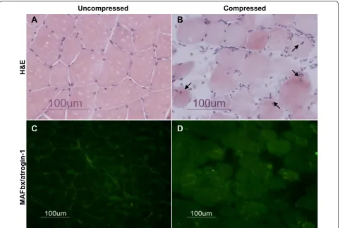 Figure 1 Compression-induced Pathohistology and Increase in MAFbx/atrogin-1untreated rats (neither DMSO nor MG132) to the compression protocol to examine the effect of compression on gross muscle histology andexpression of ubiquitin E3 ligases, MAFbx/atrog