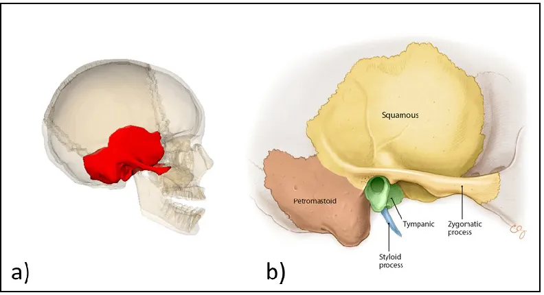 Figure 1-3a.  