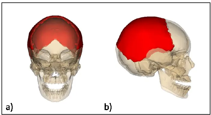Figure 1-4: Location of the two parietal bones (red) in the skull.  (a) Frontal and (b) 