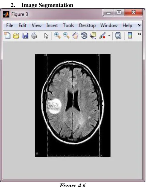 Figure 4.5   Image Segmentation Figure 4.7 
