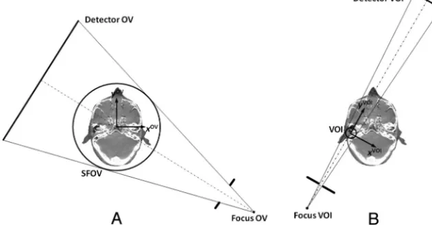 Fig 1. Definition of the C-arm FPCT geometry. A, OV scan with a wide open collimation and a large SFOV covering the complete patient cross-section