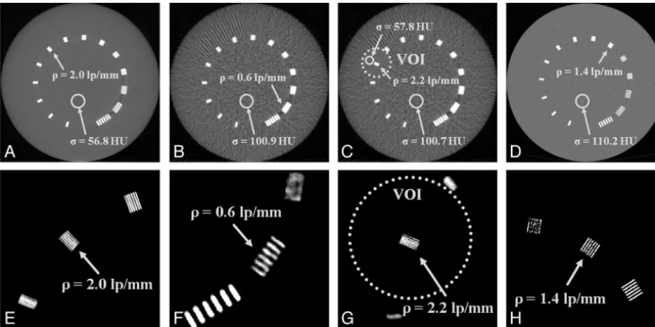 Fig 2. Measurements of a bar pattern phantom to determine spatial resolution (Detailed images of the respective resolution bar pattern (center(�) and image noise (�)