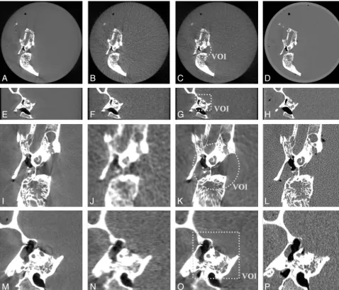 Fig 3. Measurements of an inner ear specimen. Complete transversal views (widthThe first column shows the HD scan; the second column, the OV scan; the third column, the combination of the OV and VOI scans; and the last column, the MSCT scan (centerA�D), co