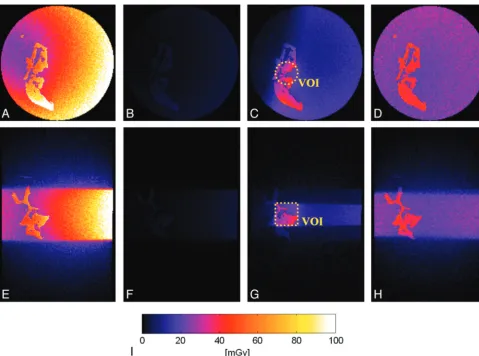 Fig 4. Monte Carlo dose simulations for the different scanning approaches in transversal (A�D) and coronal views (E�H) for the HD scan (A and E), the OV scan (B and F), the combinationof OV and VOI scans (C and G), and the MSCT scan (D and H)
