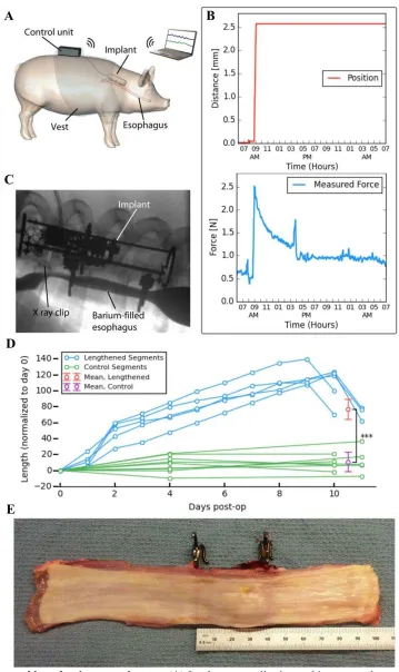 Fig 2. Esophageal lengthening experiments.  (A) Implant controller located in vest pocket communicates wirelessly with laptop computer