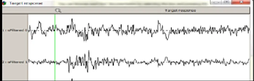 Fig 1- Target Response 