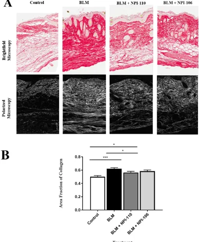 Figure 6. Peptide NPI-110 but not NPI-106 reduces the area fraction of collagen. (A) Picrosirius Red stained paraffin-processed histology sections of mice from four treatment groups on day 28 visualized with brightfield (top) and polarized (bottom) microsc