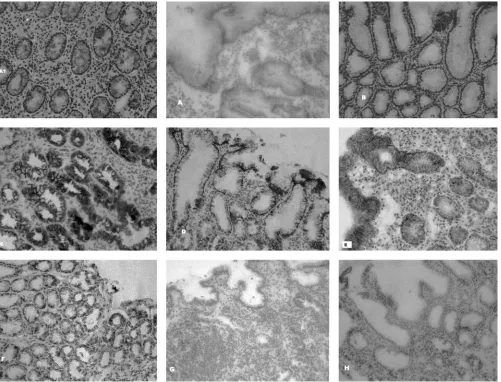 FIG. 2. Microphotographs showing immunohistochemical detection of cytokines in cryopreserved antral tissue specimens from Hinfected and uninfected subjects