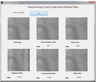 Figure 3.PSNR values of palm vein image using various filters 