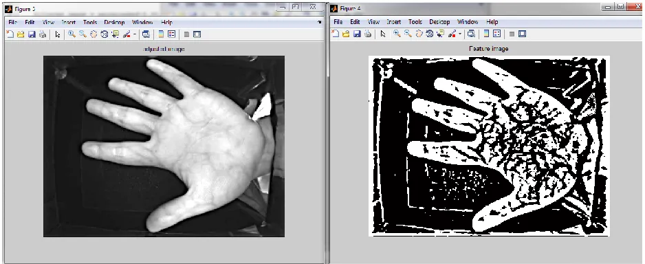 Figure 4. Contrast Enhancement and Segmentation of the palm vein image 