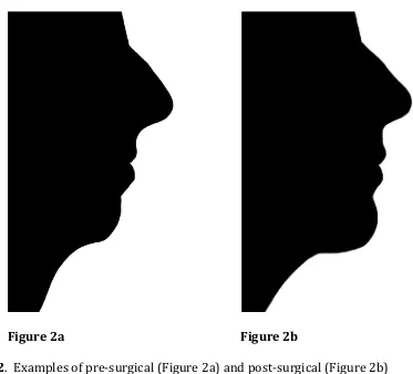 Figure 
  2. 
   
  Examples 
  of 
  pre-­‐‑surgical 
  (Figure 
  2a) 
  and 
  post-­‐‑surgical 
  (Figure 
  2b) 
  silhouettes 
  created 
  from 
  patient 
  photographs 
  using 
  PhotoshopTM 
  software