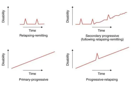 Figure 1.2. Clinical types of MS (with permission from Fred D. Lublin, M.D, (2016)) 