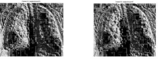 Fig 4 represent the input image with cancer .Here the image is preprocessed to improve the image Quality