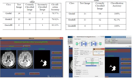 Fig 6: After Preprocessing and Segmentation                                   