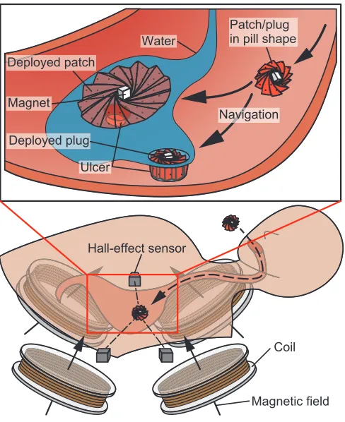 Fig. 1.The use scenario of programmable patch and plug. The patient,who has an ulcer in the stomach, ingests the origami structure folded intoits pill form