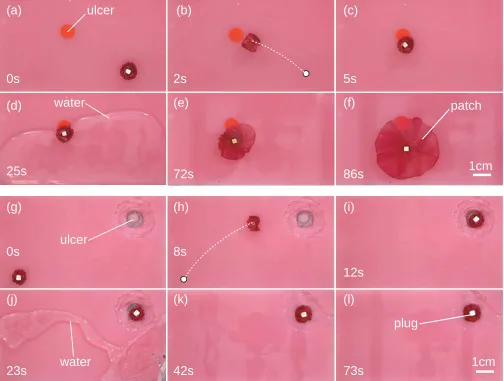 Fig. 9.Entire demonstration of the autonomous patch (a)-(f) and plug (g)-(l). (a),(g) The folded structure is placed on the surface (Ecoﬂex 00-50), andpatching the ulcer