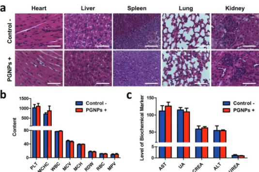 Fig. 6 (a) H&amp;E staining of major organs (heart, liver, spleen, lungs and kidneys) of mice in the Control  and PGNPs + groups