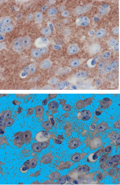 Figure 4.4  High power section from AGA-control fetus of SYN IR in the thalamus. Showing SYN IR punctate staining in the original HPF for analysis (top) and the threshold applied (blue) indicating positive stain (bottom) (image at 63x magnification, scale 
