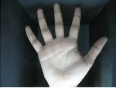Figure (5) hand palm image with true color