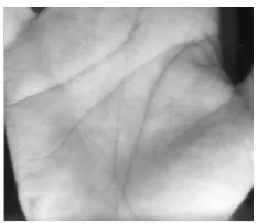 Figure (8) ROI1 in gray hand palm image 