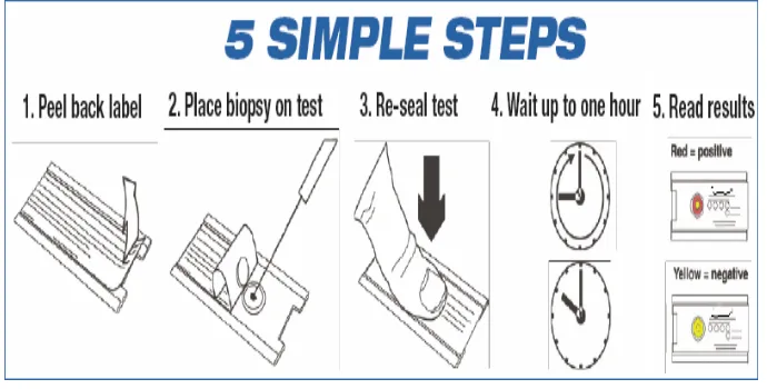 Fig 8: Steps of  doing Rapid Urease Test 