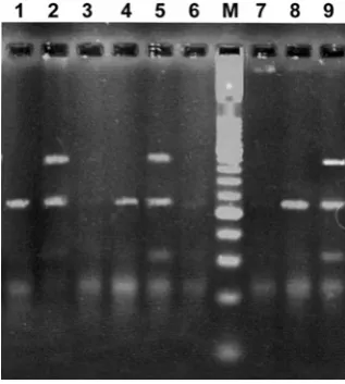 Figure 1.  PCR amplification products of H-pylori ureC gene. Lanes: 1-11 biopsy samples, 12 positive control, 13 negative control and M, molecular weight marker (XIII Roche)